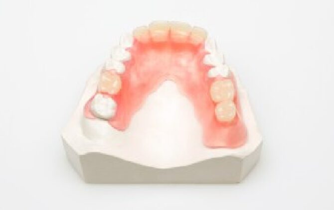 Labo-Vanderbeken-Flexibele Prothese