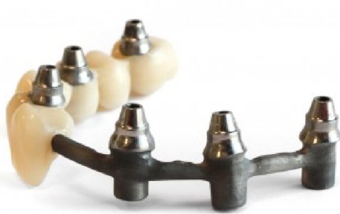 Labo-Vanderbeken-Innodema Temp Bridge