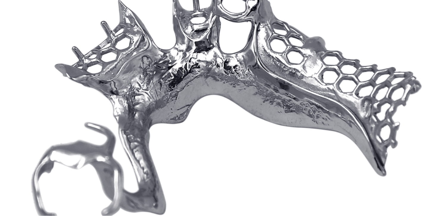 Metaalframe- en digitale frameprothese