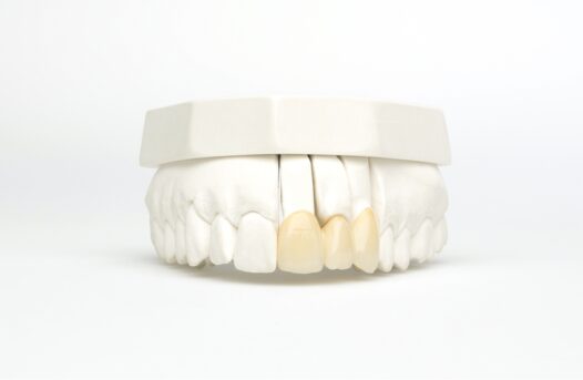 Zirkonium porseleinfront